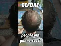 BALDING Man Gets A VIKINGS BUZZ CUT TRANSFORMATION