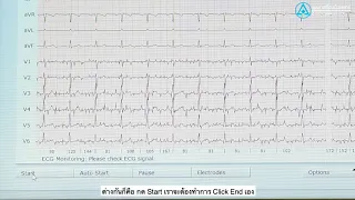 เครื่อง EKG DICOM ประกอบด้วยส่วนใดบ้าง