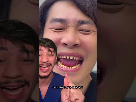 Ele botou "lentes dental" e esqueceu que tem um preço alto.
