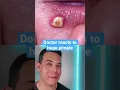 Download Lagu HUGE Painful Pimple on the￼ lip! | 208SkinDoc