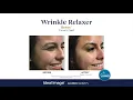 Ideal Image MedSpa