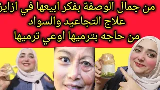من جمال الوصفة بفكر ابيعها في ازايز أقوى وارخص زيت بالعالم للقضاء على التجاعيد زي البوتوكس وتبيض عجب