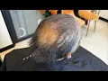 CCCA Hair Loss Transformation Live Salon Hair Weave Install Hair Restoration Talk