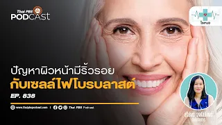ริ้วรอยบนใบหน้าเกิดจากอะไรบ้าง