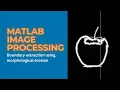 Boundary extraction in morphological image processing Boundary Extraction using Erosion