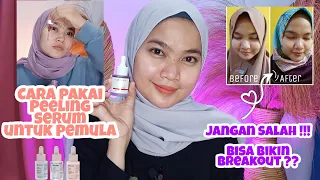 cara pakai peeling serum yang benar untuk pemula cara pakai peeling serum implora peeling serum