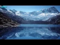 Actos De Un Tonto - Conjunto Primavera