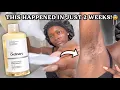 I used the ORDINARY GLYCOLIC TONER everyday for 2 weeks and this happened