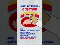 Emergency C-Section Explained in 60s Step 2 OB-GYN High-Yield Mnemonic