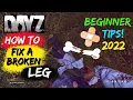 DAYZ Beginner Tips DAYZ How To Fix A Broken Leg How To Make a Splint in DAYZ DAYZ For Beginners