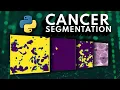 I tried building an ML Cancer Segmentation API in 15 Minutes