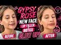Gypsy Rose Gets Lip Filler Botox Before After