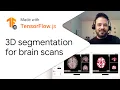 3D MRI brain segmentation - Made with TensorFlow js
