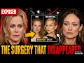 Nicole Kidman s Hidden Face Surgery EXPOSED