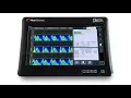 MyoVista Wavelet ECG Signal Processing