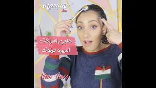                عالجي الفراغات الديرما للانبات دندنها