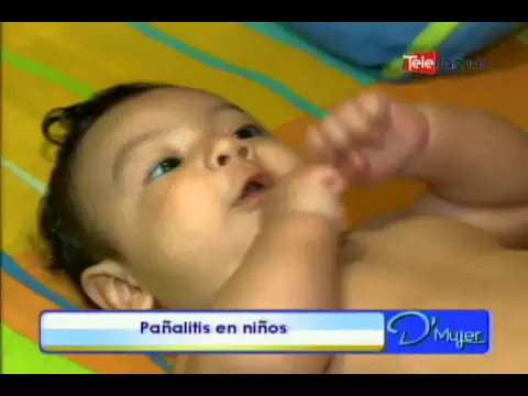 Pañalitis en niños