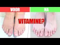 Download Lagu Deze VITAMINE vermindert zwellingen in benen en voeten