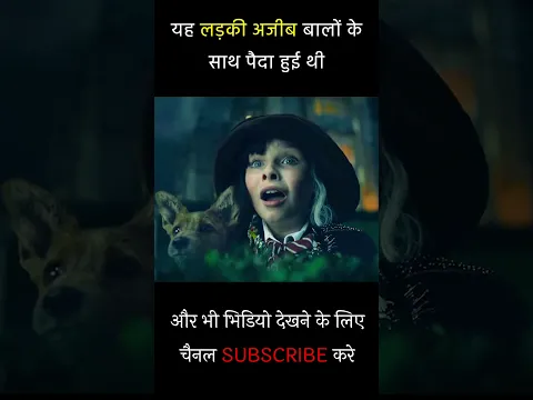 यह लड़की अजीब बालों के साथ पैदा हुई थी #shortvideo #shorts