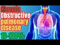 COPD And Respiratory VA Disability Claims Ratings And Secondary VA Disability Claims