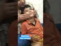 Oral Motor Massage Therapy for special child Speech Delayed in child