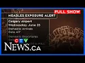 Download Lagu Measles exposure alert issued for Calgary airport | CTV Morning Live Calgary for June 27, 2025