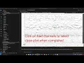 EEG preprocessing