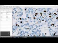 1 - Introduction to QuPath for IHC analysis