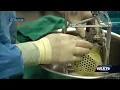 UofL Jewish Hospital performs world s first ever artificial heart transplant