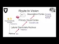 Tricky Topics Visual Pathway