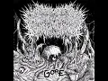 XAVLEGBMAOFFFASSSSITIMIWOAMNDUTROABCWAPWAEIIPPOHFFFX - Pneumonoultramicroscopicsilicovolcanoconio