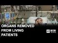Federal review finds organ group acted on donors who were still alive