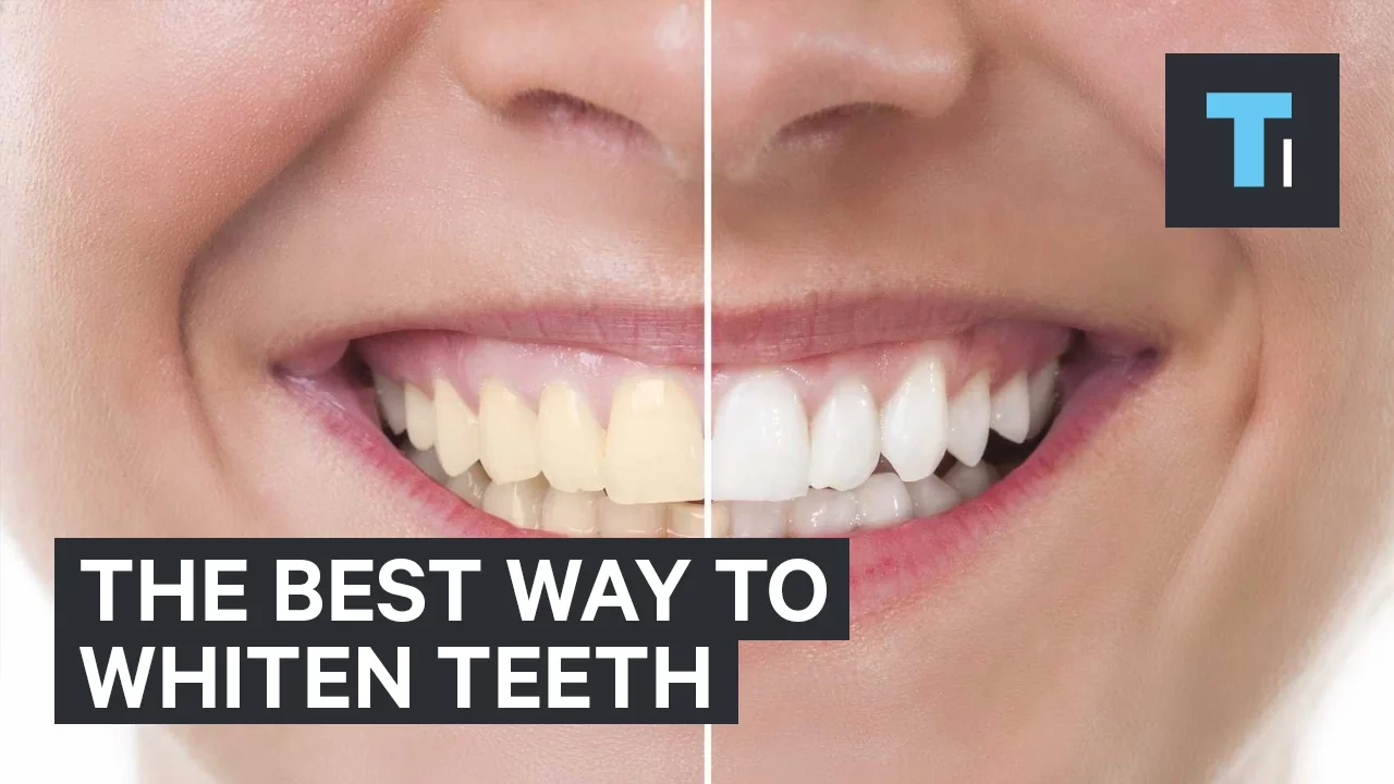 Outline Video The best way to whiten teeth