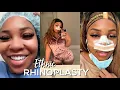 Download Lagu I GOT A NOSE JOB IN BEVERLY HILLS | VLOG | Gina Jyneen