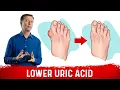 Download Lagu 4 Ways  to Neutralize Uric Acid