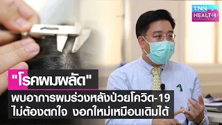 ผมร่วงหลังจากติดเชื้อโควิด-19 เกิดจากสาเหตุอะไร และเป็นเรื่องปกติหรือไม่