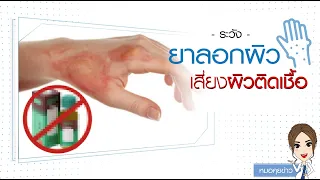 ซีมาโลชั่นที่ใช้รักษาผิวมีผลข้างเคียงอย่างไรบ้าง