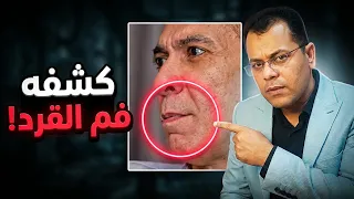 حقائق صادمة في ملامح ضياء العوضي هل كان يتوقع نهايته     اسرار علم الفراسة دندنها
