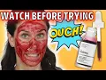 I used the ordinary peeling solution for 3 years and THIS is what it did to my face