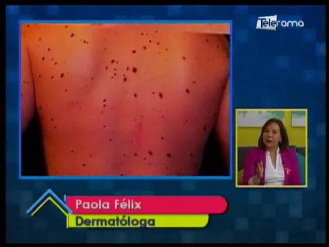 Causas del cáncer de piel