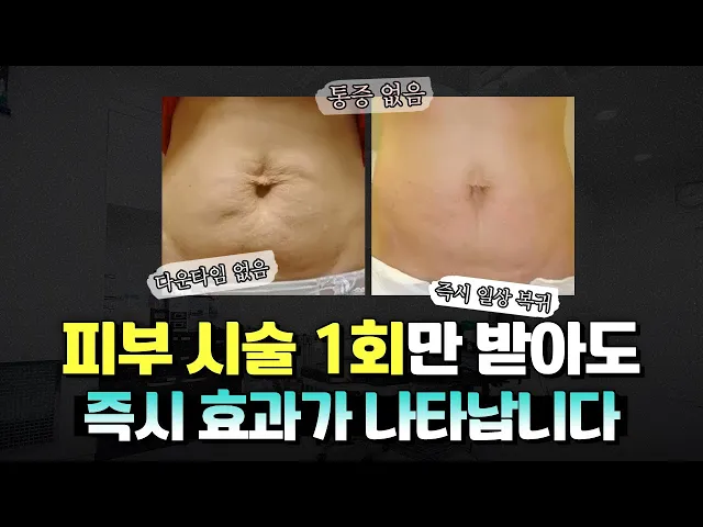 얼굴부터 몸까지, 전신 리프팅 하루에 가능할까?
