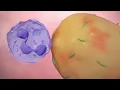 Neutrophil chemotaxis and phagocytosis