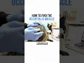 How to Find the Occipitalis Muscle