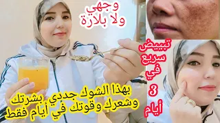الى عندك هذه الأعراض  بلاما تحلمي بوجهك يصفى🤫عليك بهذا شوك ونساي السخفة والعياء وضعف المناعة تصبغات 