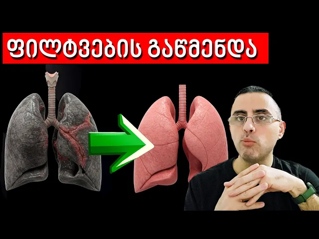 როგორ გავიწმინდოთ ფილტვები - 5 საუკეთესო საშუალება