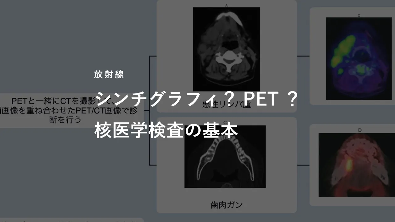 シンチグラフィ？PET？核医学検査の基本