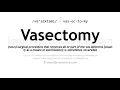 Vasectomy pronunciation and definition