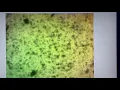 Download Lagu Praziquantel 600mg per Liter vs Coral RTN parasite Philaster