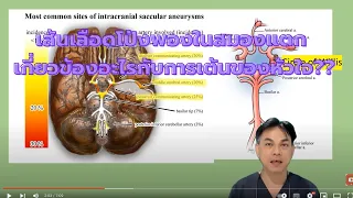 เส้นเลือดในสมองโป่งพอง หรือ aneurysm เกิดขึ้นได้ที่ไหนบ้างของร่างกาย และถ้าเกิดในสมองจะเรียกว่าอะไร