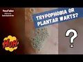 Download Lagu Trypophobia or plantar warts? #shorts
